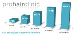 haartransplantatie