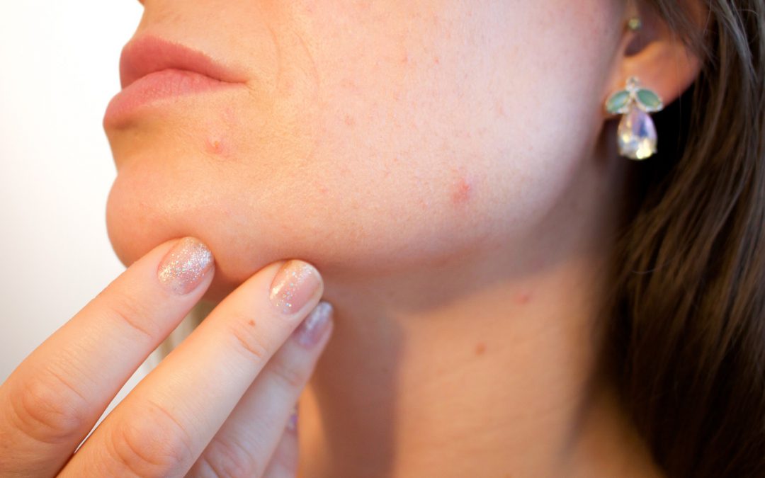 4 tips voor het verbeteren van je huid